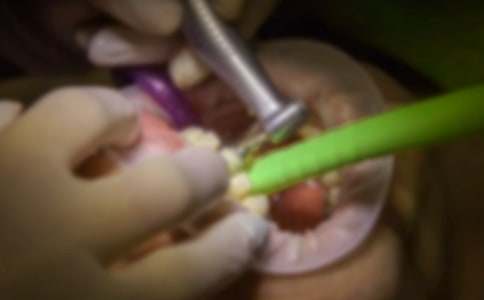 梦见自己拔牙结果又长出新牙